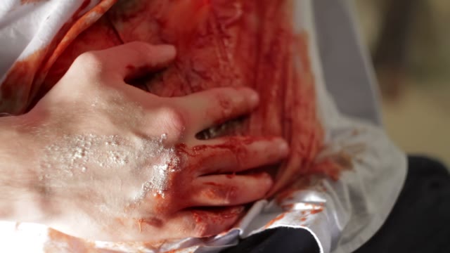Man With A Bleeding Wound Close-up