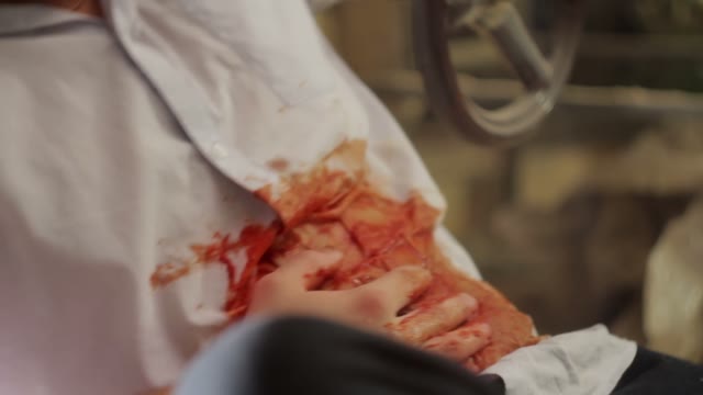 Man With A Bleeding Wound Close-up