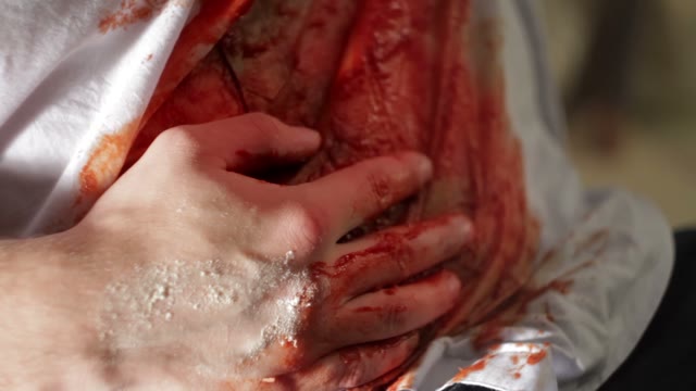 Man With A Bleeding Wound Close-up