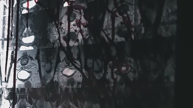 A Terrible Wall With A Lot Of X-rays Images