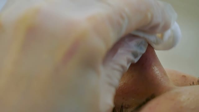 Cosmetologist Does The Nose Cleaning Close-up
