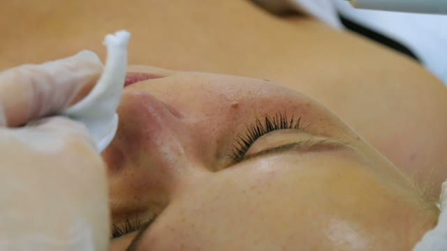 Cosmetologist Does The Nose Cleaning Close-up
